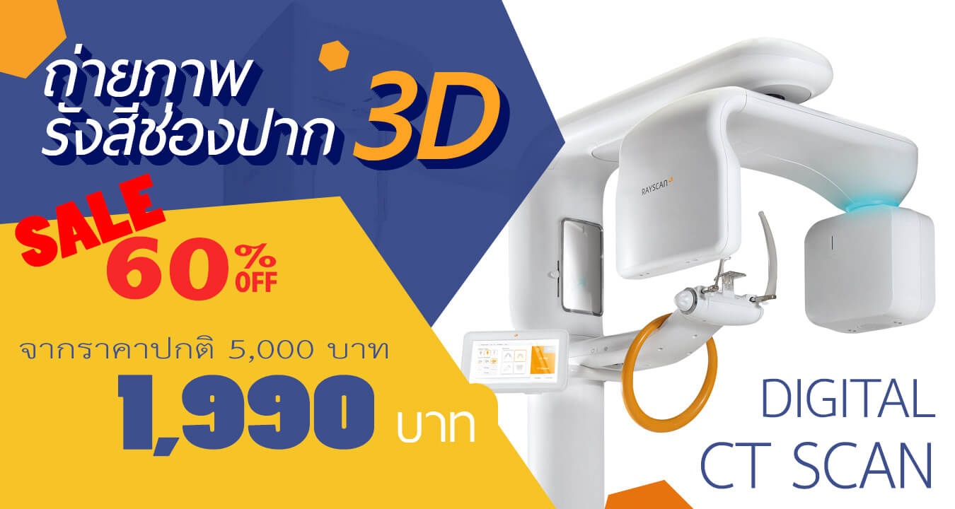 โปรโมชั่น CT Scan