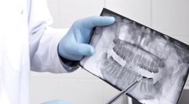 คำแนะนำหลังจากถอดเครื่องมือจัดฟัน