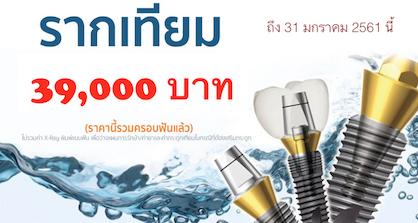 โปรโมชั่นรากเทียม